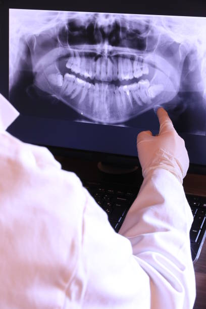 Best Knocked-Out Tooth (Avulsed Tooth) Treatment in Fords Prairie, WA