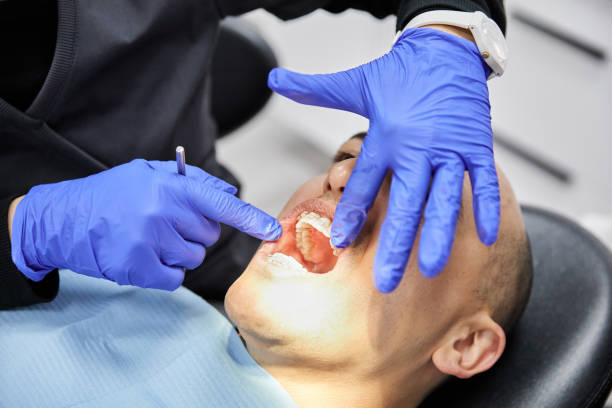 Best Knocked-Out Tooth (Avulsed Tooth) Treatment in Fords Prairie, WA
